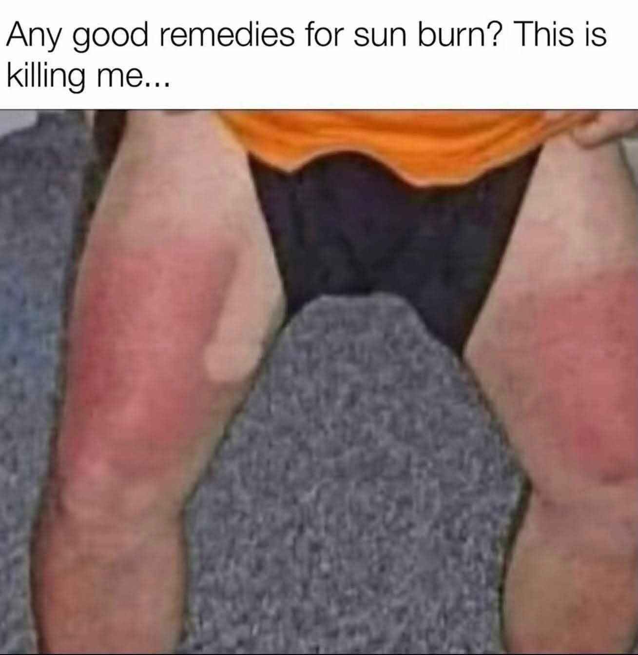 moisturiser_will_help.jpg